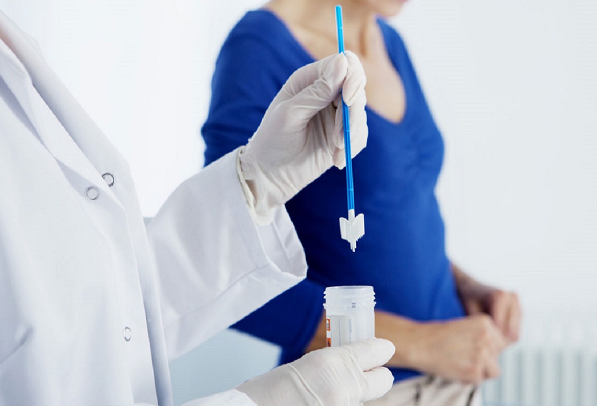 Il Pap Test spiegato in 8 semplici punti