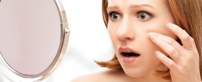 irsutismo femminile|irsutismo femminile